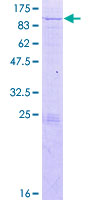 KLHL20 Protein - 12.5% SDS-PAGE of human KLHL20 stained with Coomassie Blue