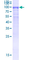 KLHL21 Protein - 12.5% SDS-PAGE of human KLHL21 stained with Coomassie Blue
