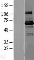 KLHL22 Protein - Western validation with an anti-DDK antibody * L: Control HEK293 lysate R: Over-expression lysate