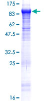 KLHL22 Protein - 12.5% SDS-PAGE of human KLHL22 stained with Coomassie Blue