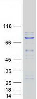 KLHL22 Protein - Purified recombinant protein KLHL22 was analyzed by SDS-PAGE gel and Coomassie Blue Staining