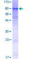 KLHL23 Protein - 12.5% SDS-PAGE of human KLHL23 stained with Coomassie Blue