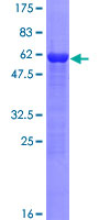 KLHL3 Protein - 12.5% SDS-PAGE of human KLHL3 stained with Coomassie Blue