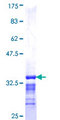KLHL3 Protein - 12.5% SDS-PAGE Stained with Coomassie Blue.
