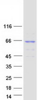 KLHL30 Protein - Purified recombinant protein KLHL30 was analyzed by SDS-PAGE gel and Coomassie Blue Staining