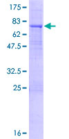 KLHL32 Protein - 12.5% SDS-PAGE of human KLHL32 stained with Coomassie Blue