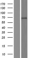 KLHL35 Protein - Western validation with an anti-DDK antibody * L: Control HEK293 lysate R: Over-expression lysate