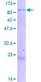 KLHL4 Protein - 12.5% SDS-PAGE of human KLHL4 stained with Coomassie Blue