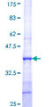 KLHL4 Protein - 12.5% SDS-PAGE Stained with Coomassie Blue.