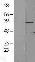 KLHL6 Protein - Western validation with an anti-DDK antibody * L: Control HEK293 lysate R: Over-expression lysate