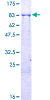 KLHL6 Protein - 12.5% SDS-PAGE of human KLHL6 stained with Coomassie Blue
