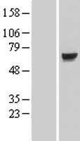 KLHL7 Protein - Western validation with an anti-DDK antibody * L: Control HEK293 lysate R: Over-expression lysate