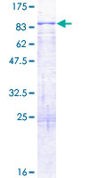 KLHL8 Protein - 12.5% SDS-PAGE of human KLHL8 stained with Coomassie Blue