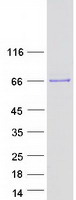KLHL8 Protein - Purified recombinant protein KLHL8 was analyzed by SDS-PAGE gel and Coomassie Blue Staining