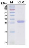 KLK1 / Kallikrein 1 Protein - SDS-PAGE under reducing conditions and visualized by Coomassie blue staining