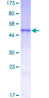 KLK1 / Kallikrein 1 Protein - 12.5% SDS-PAGE of human KLK1 stained with Coomassie Blue