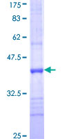 KLK1 / Kallikrein 1 Protein - 12.5% SDS-PAGE Stained with Coomassie Blue.