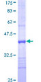 KLK1 / Kallikrein 1 Protein - 12.5% SDS-PAGE Stained with Coomassie Blue.