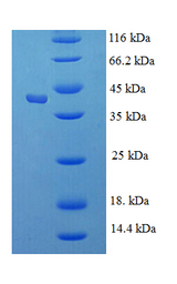 KLK1 / Kallikrein 1 Protein