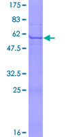 KLK10 / Kallikrein 10 Protein - 12.5% SDS-PAGE of human KLK10 stained with Coomassie Blue