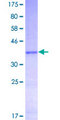 KLK10 / Kallikrein 10 Protein - 12.5% SDS-PAGE Stained with Coomassie Blue.
