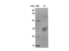 KLK10 / Kallikrein 10 Protein - Recombinant Human KLK10 Protein (His Tag)-Elabscience