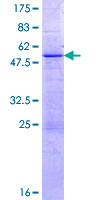 KLK11 / Kallikrein 11 Protein - 12.5% SDS-PAGE of human KLK11 stained with Coomassie Blue