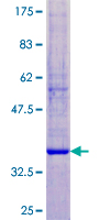 KLK12 / Kallikrein 12 Protein - 12.5% SDS-PAGE of human KLK12 stained with Coomassie Blue