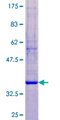 KLK12 / Kallikrein 12 Protein - 12.5% SDS-PAGE of human KLK12 stained with Coomassie Blue