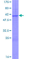 KLK13 / Kallikrein 13 Protein - 12.5% SDS-PAGE of human KLK13 stained with Coomassie Blue