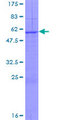 KLK13 / Kallikrein 13 Protein - 12.5% SDS-PAGE of human KLK13 stained with Coomassie Blue