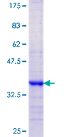 KLK13 / Kallikrein 13 Protein - 12.5% SDS-PAGE Stained with Coomassie Blue.