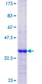 KLK13 / Kallikrein 13 Protein - 12.5% SDS-PAGE Stained with Coomassie Blue.