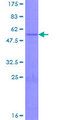 KLK14 / Kallikrein 14 Protein - 12.5% SDS-PAGE of human KLK14 stained with Coomassie Blue
