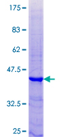 KLK15 / Kallikrein 15 Protein - 12.5% SDS-PAGE of human KLK15 stained with Coomassie Blue