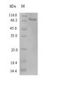 KLK2 / Kallikrein 2 Protein - (Tris-Glycine gel) Discontinuous SDS-PAGE (reduced) with 5% enrichment gel and 15% separation gel.