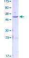 KLK2 / Kallikrein 2 Protein - 12.5% SDS-PAGE of human KLK2 stained with Coomassie Blue