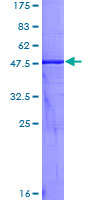 KLK2 / Kallikrein 2 Protein - 12.5% SDS-PAGE of human KLK2 stained with Coomassie Blue