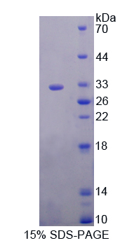 KLK2 / Kallikrein 2 Protein - Recombinant  Kallikrein 2 By SDS-PAGE