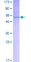 KLK3 / PSA Protein - 12.5% SDS-PAGE of human KLK3 stained with Coomassie Blue