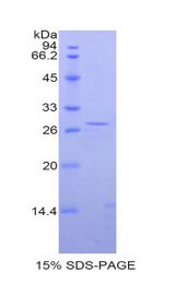 KLK3 / PSA Protein - Recombinant Kallikrein 3 (KLK3) by SDS-PAGE