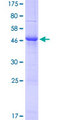 KLK4 / Kallikrein 4 Protein - 12.5% SDS-PAGE of human KLK4 stained with Coomassie Blue