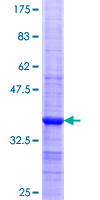 KLK4 / Kallikrein 4 Protein - 12.5% SDS-PAGE Stained with Coomassie Blue.