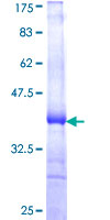 KLK5 / Kallikrein 5 Protein - 12.5% SDS-PAGE Stained with Coomassie Blue.