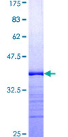 KLK6 / Kallikrein 6 Protein - 12.5% SDS-PAGE Stained with Coomassie Blue.