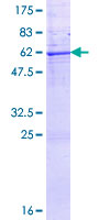KLK7 / Kallikrein 7 Protein - 12.5% SDS-PAGE of human KLK7 stained with Coomassie Blue