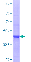 KLK7 / Kallikrein 7 Protein - 12.5% SDS-PAGE Stained with Coomassie Blue.