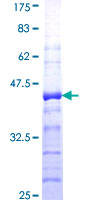 KLK8 / Kallikrein 8 Protein - 12.5% SDS-PAGE Stained with Coomassie Blue.