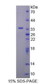 KLK8 / Kallikrein 8 Protein - Recombinant  Kallikrein 8 By SDS-PAGE