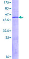 KLK9 / Kallikrein 9 Protein - 12.5% SDS-PAGE of human KLK9 stained with Coomassie Blue
